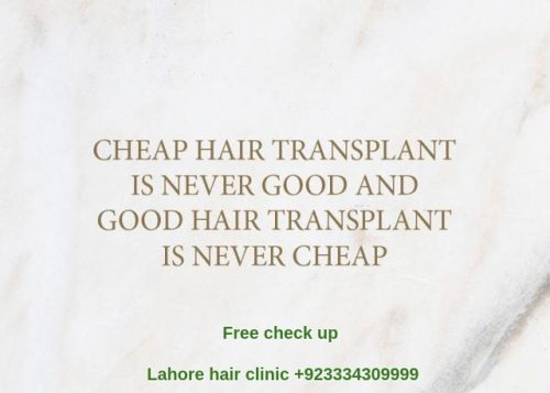 Cheap hair transplant Lahore Pakistan