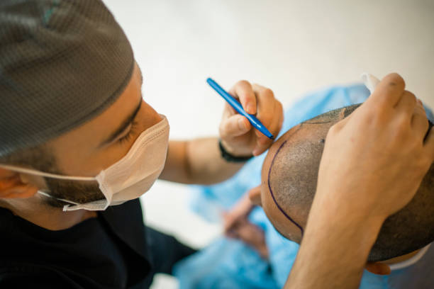 Read more about the article Hair transplant surgeon Lahore