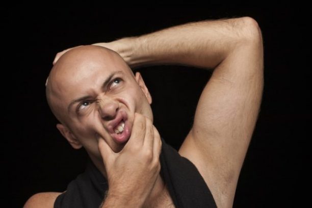 Read more about the article Male Pattern Baldness