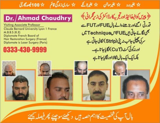 hair transplant result in Lahore