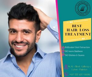 Read more about the article Hair transplant