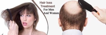 You are currently viewing Hair loss treatment Australia