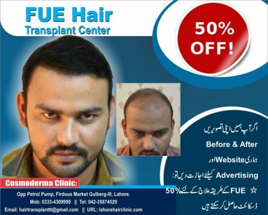 Hair transplant cost Lahore