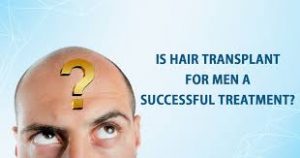 Read more about the article How successful is a hair transplant