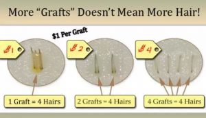 Read more about the article Hair graft cost