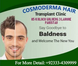 Read more about the article Hair transplant young patient