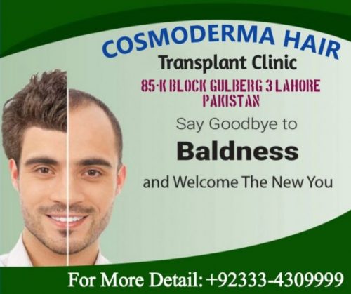 Read more about the article Hair transplant young patient