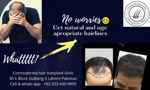 Hair loss treatment through hair transplant