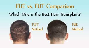 Fue Vs FUT comparison