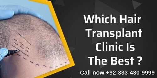 Choose best clinic