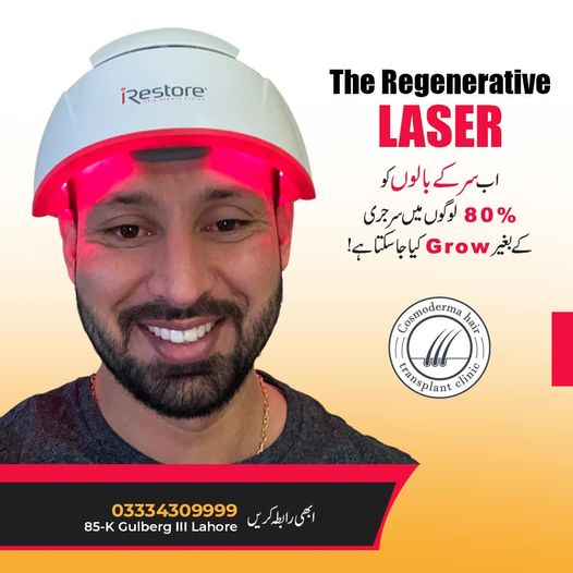 Laser treatment for hair loss Lahore Pakistan