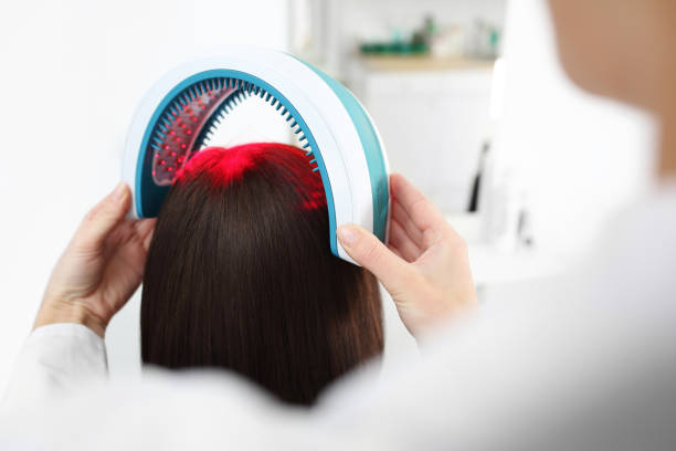Low level laser therapy female hair loss treatment 